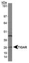 TP53 Induced Glycolysis Regulatory Phosphatase antibody, NBP1-49534, Novus Biologicals, Western Blot image 