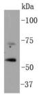 Tumor Protein P73 antibody, A00688, Boster Biological Technology, Western Blot image 