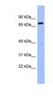 Regulator Of G Protein Signaling 9 antibody, NBP1-58909, Novus Biologicals, Western Blot image 