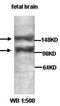 Amyloid Beta Precursor Protein Binding Family A Member 1 antibody, orb77100, Biorbyt, Western Blot image 