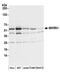 Makorin Ring Finger Protein 1 antibody, NB100-55304, Novus Biologicals, Western Blot image 