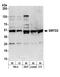 SET And MYND Domain Containing 2 antibody, A303-011A, Bethyl Labs, Western Blot image 
