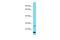 Chromosome 10 Open Reading Frame 95 antibody, A18923, Boster Biological Technology, Western Blot image 