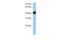 Germ Cell Associated 1 antibody, GTX45447, GeneTex, Western Blot image 