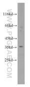 Rhomboid Like 2 antibody, 12467-1-AP, Proteintech Group, Western Blot image 