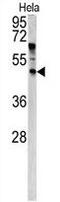 Angiopoietin Like 7 antibody, GTX81863, GeneTex, Western Blot image 