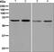 DEAD-Box Helicase 5 antibody, ab126730, Abcam, Western Blot image 