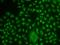 TCF3 Fusion Partner antibody, orb373398, Biorbyt, Immunocytochemistry image 