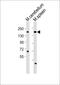 Lysine Demethylase 6A antibody, M01286, Boster Biological Technology, Western Blot image 