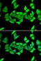 Hexose-6-Phosphate Dehydrogenase/Glucose 1-Dehydrogenase antibody, 22-223, ProSci, Immunofluorescence image 