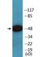 SMAD Family Member 3 antibody, LS-C291638, Lifespan Biosciences, Western Blot image 