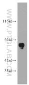 Coiled-Coil Domain Containing 9 antibody, 21104-1-AP, Proteintech Group, Western Blot image 