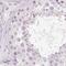 Desmoglein 3 antibody, NBP2-54744, Novus Biologicals, Immunohistochemistry paraffin image 