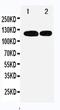 RB Transcriptional Corepressor Like 1 antibody, PA5-79916, Invitrogen Antibodies, Western Blot image 