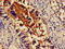 Actinin Alpha 4 antibody, LS-C671830, Lifespan Biosciences, Immunohistochemistry paraffin image 