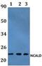 Actin Related Protein 2/3 Complex Subunit 1A antibody, PA5-75892, Invitrogen Antibodies, Western Blot image 