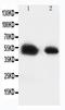 Solute Carrier Family 2 Member 8 antibody, PA2165, Boster Biological Technology, Western Blot image 