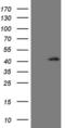 Cellular Communication Network Factor 2 antibody, MA5-26817, Invitrogen Antibodies, Western Blot image 