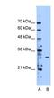 Methyltransferase Like 1 antibody, NBP1-54928, Novus Biologicals, Western Blot image 