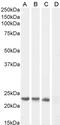 Suppressor Of Cytokine Signaling 1 antibody, PA5-17938, Invitrogen Antibodies, Western Blot image 