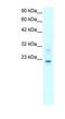 Claudin 9 antibody, NBP1-59156, Novus Biologicals, Western Blot image 