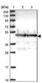 ST13 Hsp70 Interacting Protein antibody, NBP2-48786, Novus Biologicals, Western Blot image 