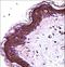 S100 Calcium Binding Protein A7 antibody, LS-C162829, Lifespan Biosciences, Immunohistochemistry frozen image 