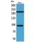 Neurotrophic Receptor Tyrosine Kinase 3 antibody, LS-C386929, Lifespan Biosciences, Western Blot image 