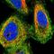 E3 ubiquitin-protein ligase MIB1 antibody, HPA019100, Atlas Antibodies, Immunofluorescence image 