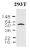 Nicotinamide Phosphoribosyltransferase antibody, GTX50049, GeneTex, Western Blot image 