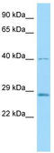 Chymotrypsin Like Elastase 3B antibody, TA334417, Origene, Western Blot image 