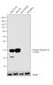 Carbonic Anhydrase 3 antibody, PA5-25977, Invitrogen Antibodies, Western Blot image 