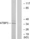 Cytosolic Thiouridylase Subunit 1 antibody, LS-C119120, Lifespan Biosciences, Western Blot image 