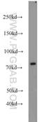 Rabphilin 3A antibody, 11396-1-AP, Proteintech Group, Western Blot image 