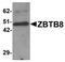 Zinc Finger And BTB Domain Containing 8A antibody, orb75553, Biorbyt, Western Blot image 