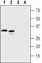 Complement Component 5a Receptor 2 antibody, PA5-77288, Invitrogen Antibodies, Western Blot image 
