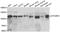 GTF2I Repeat Domain Containing 1 antibody, STJ28696, St John
