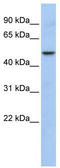 WD Repeat, Sterile Alpha Motif And U-Box Domain Containing 1 antibody, TA330512, Origene, Western Blot image 