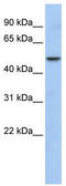 WD repeat, SAM and U-box domain-containing protein 1 antibody, TA330512, Origene, Western Blot image 