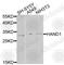 Heart And Neural Crest Derivatives Expressed 1 antibody, A9855, ABclonal Technology, Western Blot image 