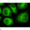 Cyclin Dependent Kinase 5 antibody, LS-C812912, Lifespan Biosciences, Immunocytochemistry image 