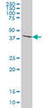 Diphthamide Biosynthesis 1 antibody, LS-C197072, Lifespan Biosciences, Western Blot image 