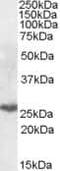 Proteasome Subunit Beta 10 antibody, PA5-19146, Invitrogen Antibodies, Western Blot image 