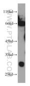 Immediate-early protein CL-6 antibody, 22115-1-AP, Proteintech Group, Western Blot image 