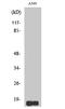 Somatostatin antibody, STJ95730, St John