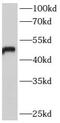 Beta-1,4-Galactosyltransferase 6 antibody, FNab00776, FineTest, Western Blot image 