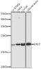 CGRP Receptor Component antibody, GTX66450, GeneTex, Western Blot image 