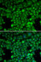 Lysozyme Like 6 antibody, STJ24438, St John