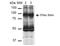 Sodium Channel Epithelial 1 Beta Subunit antibody, NBP2-59381, Novus Biologicals, Western Blot image 