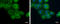 Microtubule Associated Protein 4 antibody, GTX110656, GeneTex, Immunocytochemistry image 